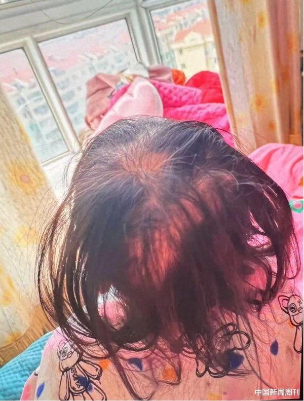 河源华锋 3岁女孩铊中毒, 医院独家回应